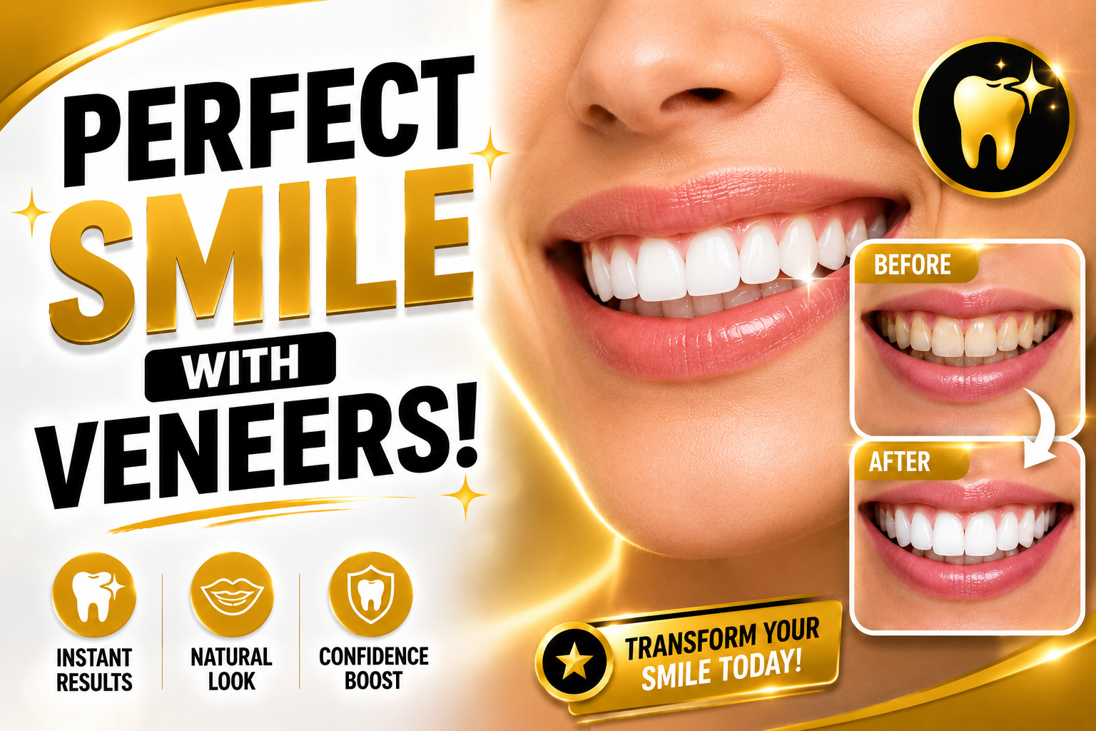 Transform Your Smile with Dental Veneers: Benefits, Procedure, and Aftercare